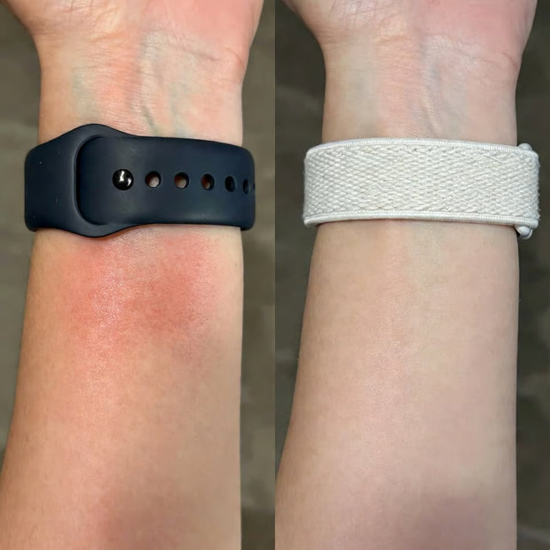 Apple Watch Band Allergy: How to Tell (and What to Do)